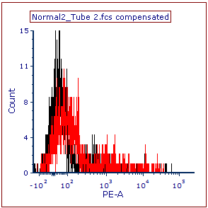 Figure T10.31 - Histogram with Overlay Figure T10.31 - Histogram with Overlay