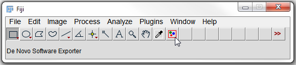Figure T27.19  ImageJ Toolbar with the DNSMacroExample.ijm Macro Installed  